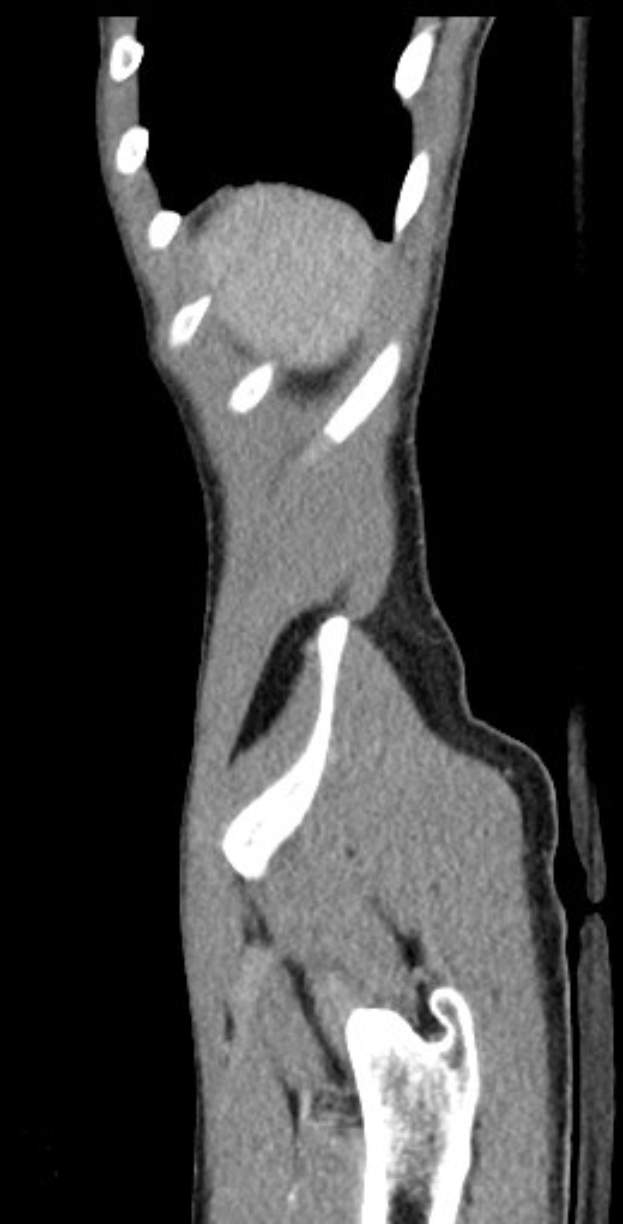 Schwarzer und weißer MRI-Scan eines Kniegelenks mit detaillierter Anatomie.