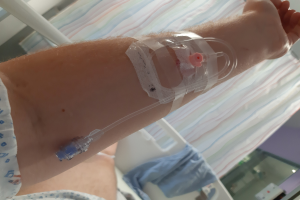 Eine Person in einem weißen Kleid liegt in einem Krankenhausbett mit einem an ihrem Bein angebrachten IV-Tropf, ein Tuch liegt über dem Bett und verschiedene Gegenstände sind im Hintergrund zu sehen.
